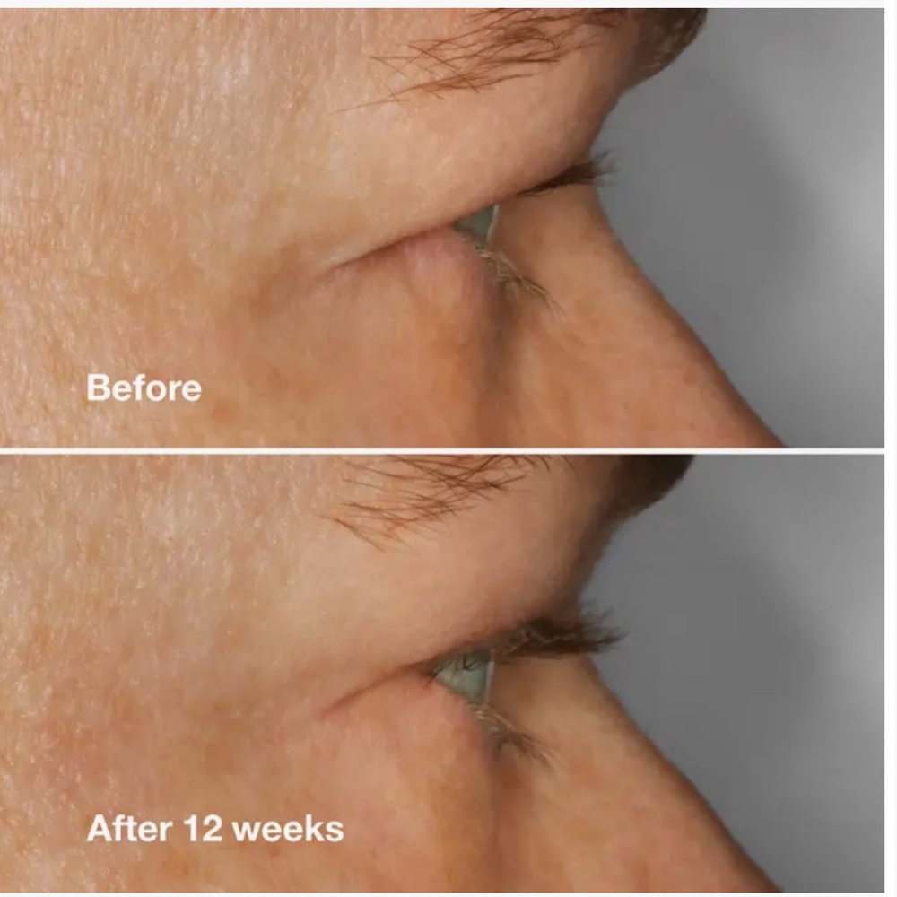 CLINIQUE High Impact Lash Amplifying Serum, NEW - Picture 3 of 7